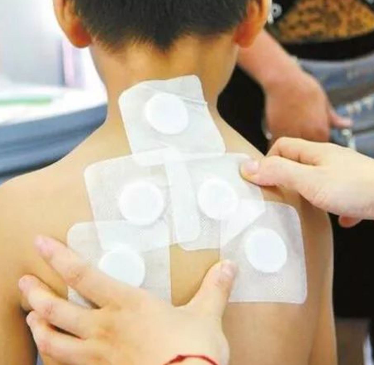 2、三伏貼在脖子上，有一根針，看起來很疼。怎么了